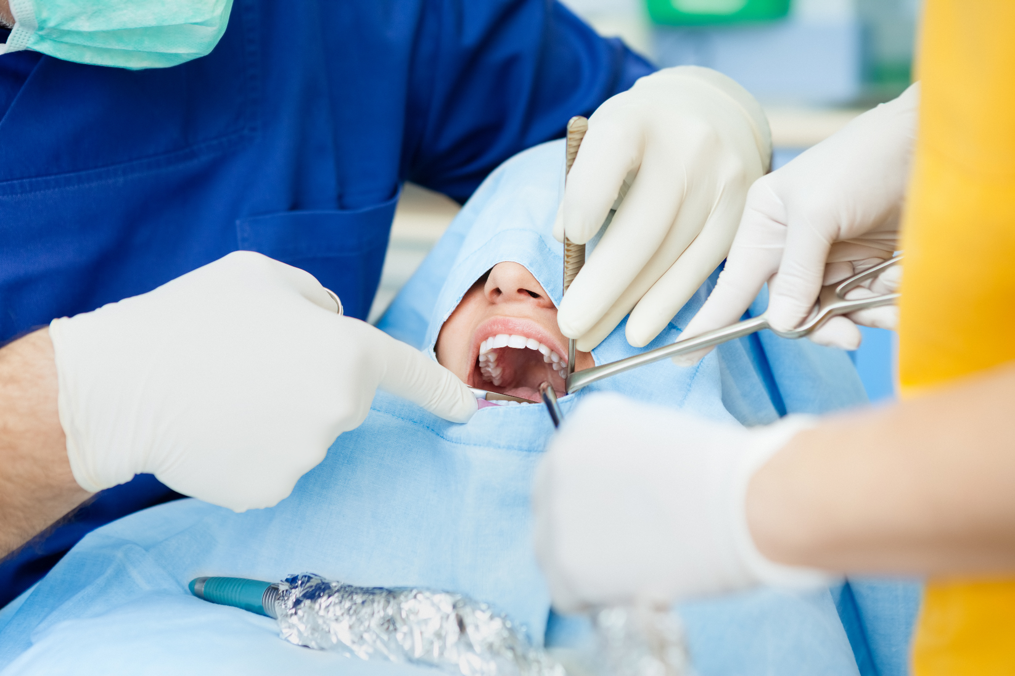 Zobna kirurgija in njene storitve